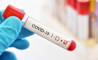 Veselības ministrija aicina izmantot valsts apmaksātos COVID 19 izmeklējumus
